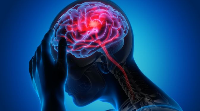 Permasalahan Penyakit Stroke yang Sering Di lalikan