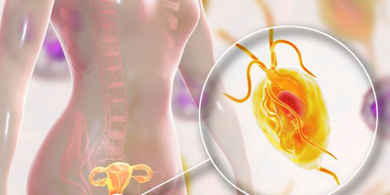 Apa Trikomoniasis Yang Harus Di Ketahui Remaja